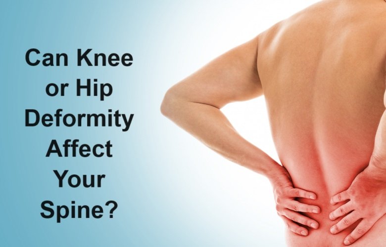 Deformity Affect Your Spine